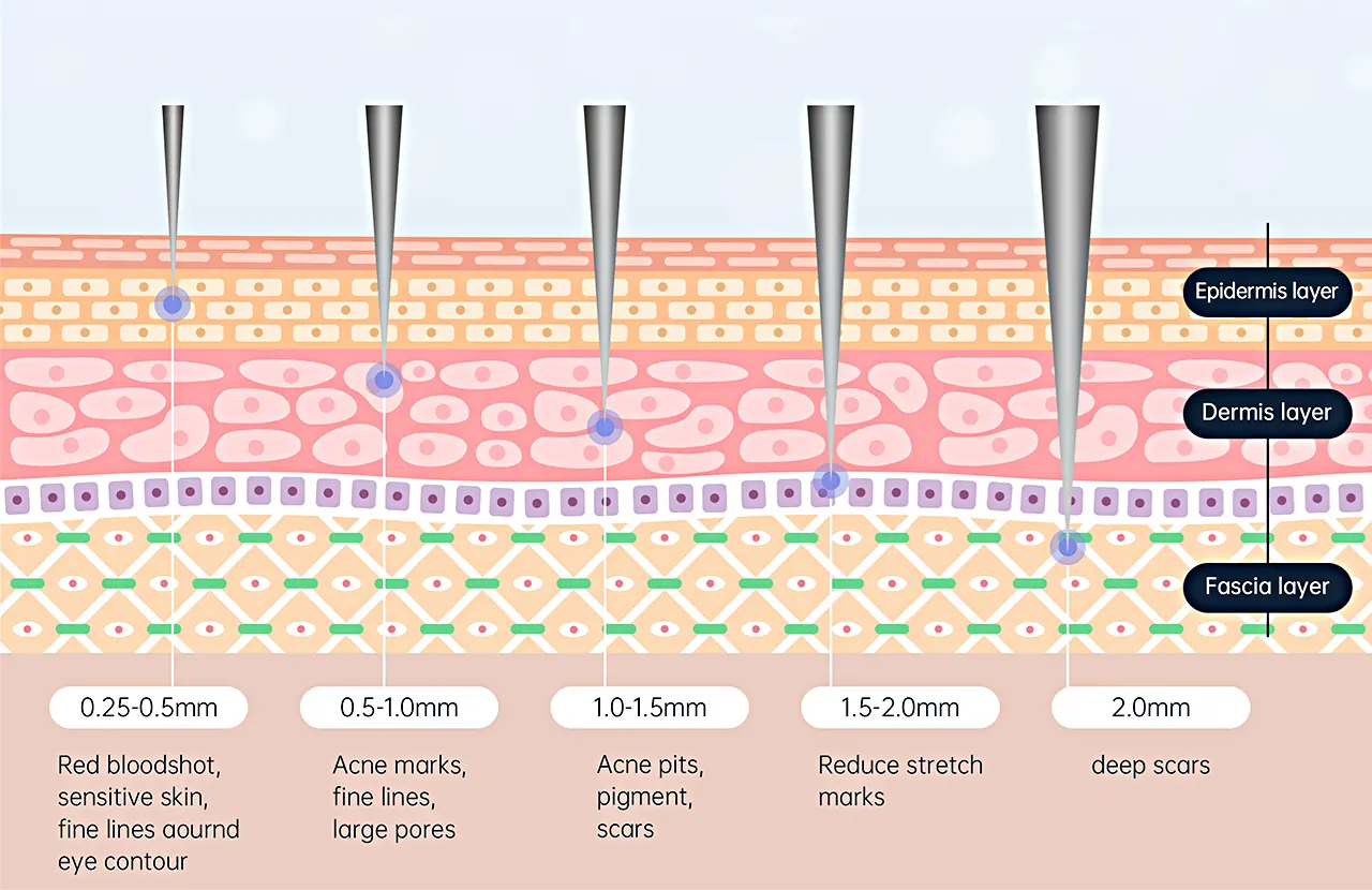 Skin structure levels and how to choose different microneedle length for skin care