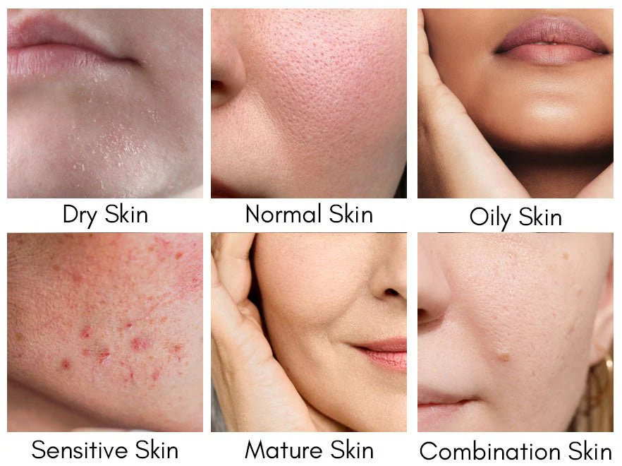 Consider your skin types