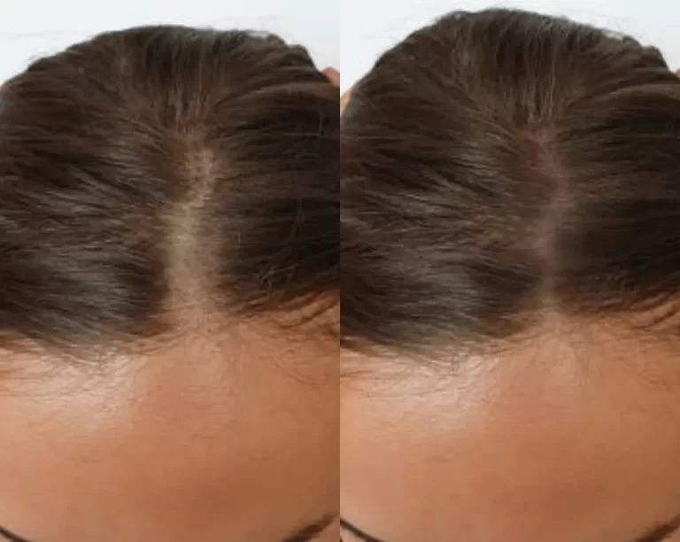 High frequency wand for hair